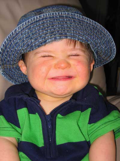 Child with hat with obvious disability